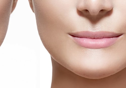 How Long Does It Take for Restylane to Settle?